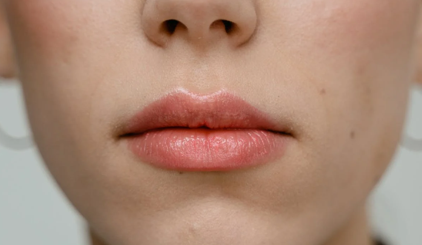 drdentobeauty.fillers.botox